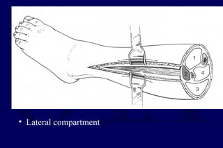 • Lateral compartment
 