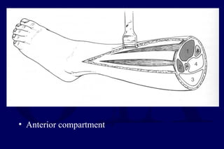 • Anterior compartment
 