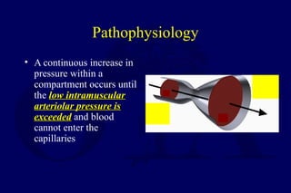 Pathophysiology
• A continuous increase in
pressure within a
compartment occurs until
the low intramuscularlow intramuscular
arteriolar pressure isarteriolar pressure is
exceededexceeded and blood
cannot enter the
capillaries
 