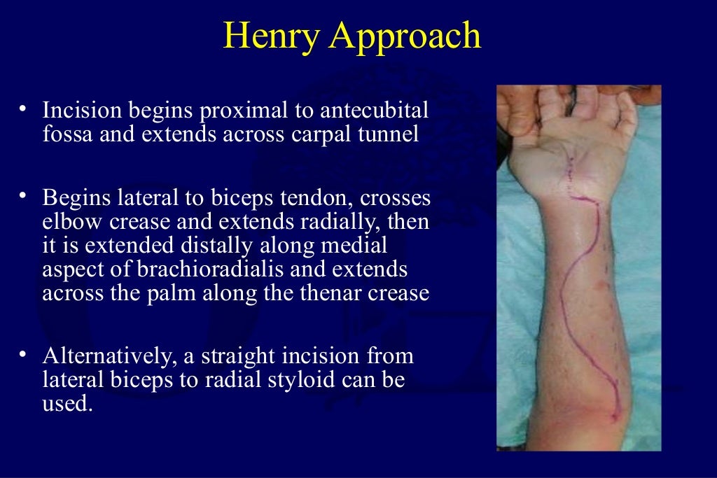compartment syndrome