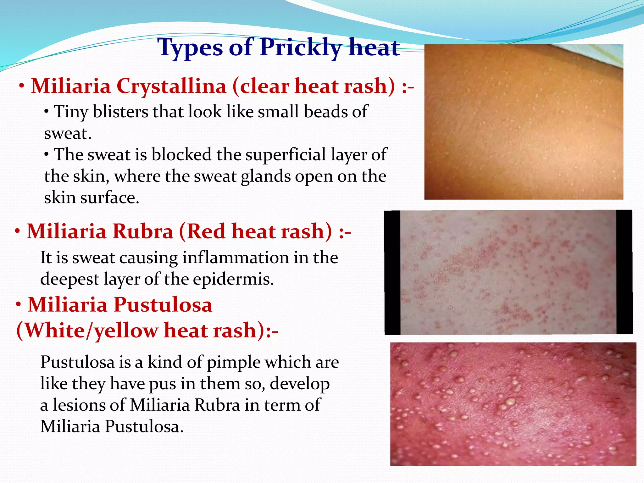 skin related problems [cosmeceutics] | PPTX