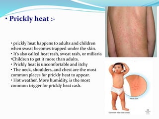 skin related problems [cosmeceutics] | PPTX