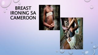 BREAST
IRONING SA
CAMEROON
 