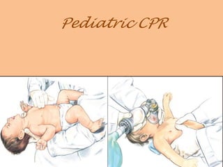 Pediatric CPR
 