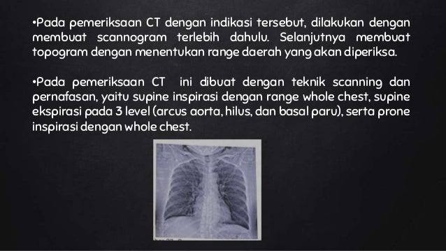 Ppt ct scan thorax pada kasus asma