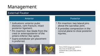 PPT CURRENT MANAGEMENT PELVIC FRACTURE edit.pptx