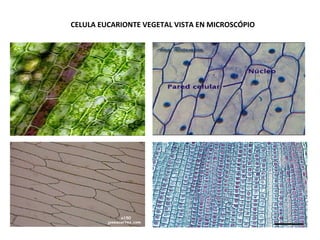 CELULA EUCARIONTE VEGETAL VISTA EN MICROSCÓPIO