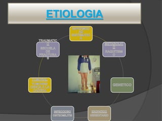 ETIOLOGIA
 
