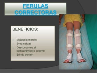 FERULAS
CORRECTORAS
BENEFICIOS:
Mejora la marcha
Evita caídas
Descomprime el
compartimiento externo
Brinda confort
 