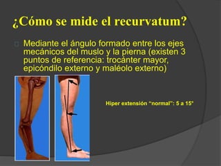 ¿Cómo se mide el recurvatum?
Mediante el ángulo formado entre los ejes
mecánicos del muslo y la pierna (existen 3
puntos de referencia: trocánter mayor,
epicóndilo externo y maléolo externo)
Hiper extensión “normal”: 5 a 15°
 