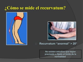 ¿Cómo se mide el recurvatum?
Recurvatum “anormal” > 20°
No existen estudios que hayan
precisado o fijado el limite de la
normalidad.
 