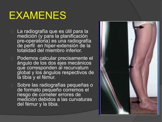 EXAMENES
La radiografía que es útil para la
medición (y para la planificación
pre-operatoria) es una radiografía
de perfil en hiper-extensión de la
totalidad del miembro inferior.
Podemos calcular precisamente el
ángulo de los dos ejes mecánicos
que corresponden al recurvatum
global y los ángulos respectivos de
la tibia y el fémur.
Sobre las radiografías pequeñas o
de formato pequeño corremos el
riesgo de cometer errores de
medición debidos a las curvaturas
del fémur y la tibia.
 
