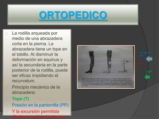 ORTOPEDICO
La rodilla arqueada por
medio de una abrazadera
corta en la pierna. La
abrazadera tiene un tope en
el tobillo. Al disminuir la
deformación en equinus y
así la secundaria en la parte
posterior de la rodilla, puede
ser eficaz impidiendo el
recurvatum.
Principio mecánico de la
abrazadera:
Tope (T)
Presión en la pantorrilla (PP)
Y la excursión permitida
(flecha curva) de las barras
ABRAZADE
RA
TOP
E
 