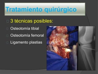 3 técnicas posibles:
Osteotomía tibial
Osteotomía femoral
Ligamento plastias
Tratamiento quirúrgico
 