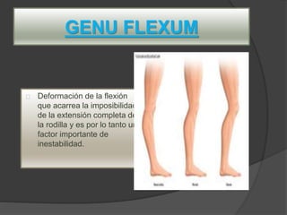 GENU FLEXUM
Deformación de la flexión
que acarrea la imposibilidad
de la extensión completa de
la rodilla y es por lo tanto un
factor importante de
inestabilidad.
 