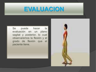 EVALUACION
Se puede hacer la
evaluación en un plano
sagital y posterior, lo cual
observaremos la flexión y el
grado de flexión que el
paciente tiene.
 