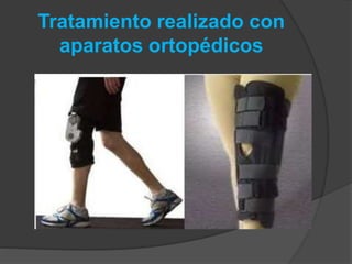 Tratamiento realizado con
aparatos ortopédicos
 