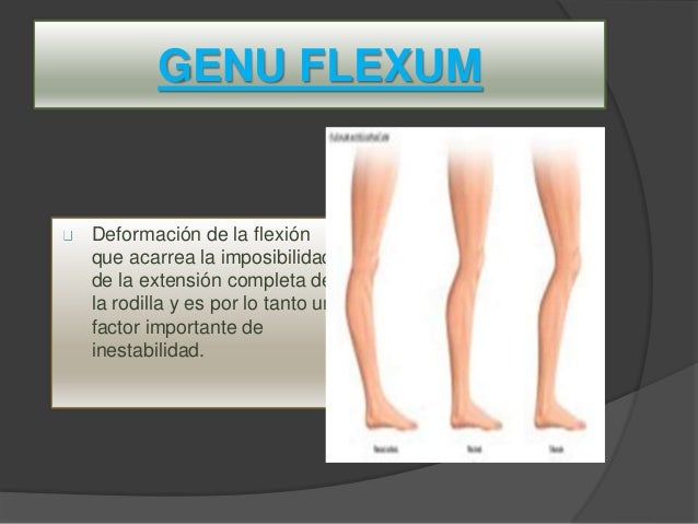 DEFORMIDADES DE RODILLA DEFORMIDADES DE RODILLA