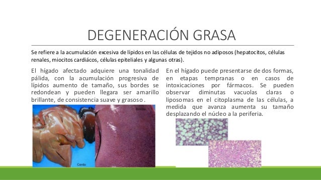 degeneraciones necrosis