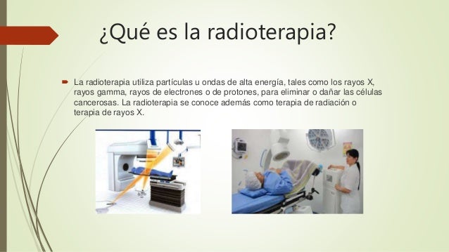 Radioterapia