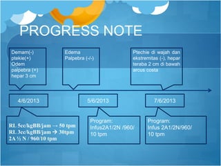PROGRESS NOTE
Demam(-)
ptekie(+)
Odem
palpebra (+)
hepar 3 cm
4/6/2013
Edema
Palpebra (-/-)
5/6/2013
Ptechie di wajah dan
ekstremitas (-), hepar
teraba 2 cm di bawah
arcus costa
7/6/2013
Program:
Infus 2A1/2N/960/
10 tpm
Program:
Infus2A1/2N /960/
10 tpm
RL 5cc/kgBB/jam → 50 tpm
RL 3cc/kgBB/jam  30tpm
2A ½ N / 960/10 tpm
 