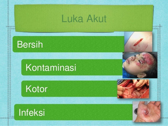 Penatalaksanaan Luka