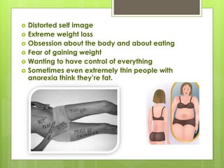  Distorted self image
 Extreme weight loss
 Obsession about the body and about eating
 Fear of gaining weight
 Wanting to have control of everything
 Sometimes even extremely thin people with
anorexia think they’re fat.
 