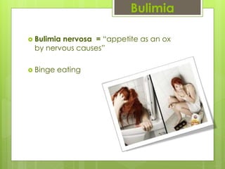 Bulimia
 Bulimia nervosa = “appetite as an ox
by nervous causes”
 Binge eating
 