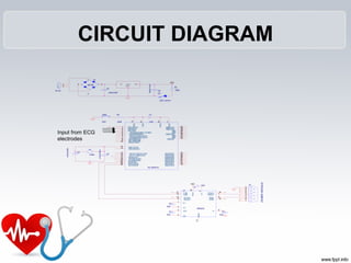 CIRCUIT DIAGRAM
VCC
VCC
Input from ECG
electrodes
9V AC
1
21
2
C6
100uF/16V
R3
330E
C5
470uF/25V
- +
D1
DB106
1
2
3
4
D3
S...