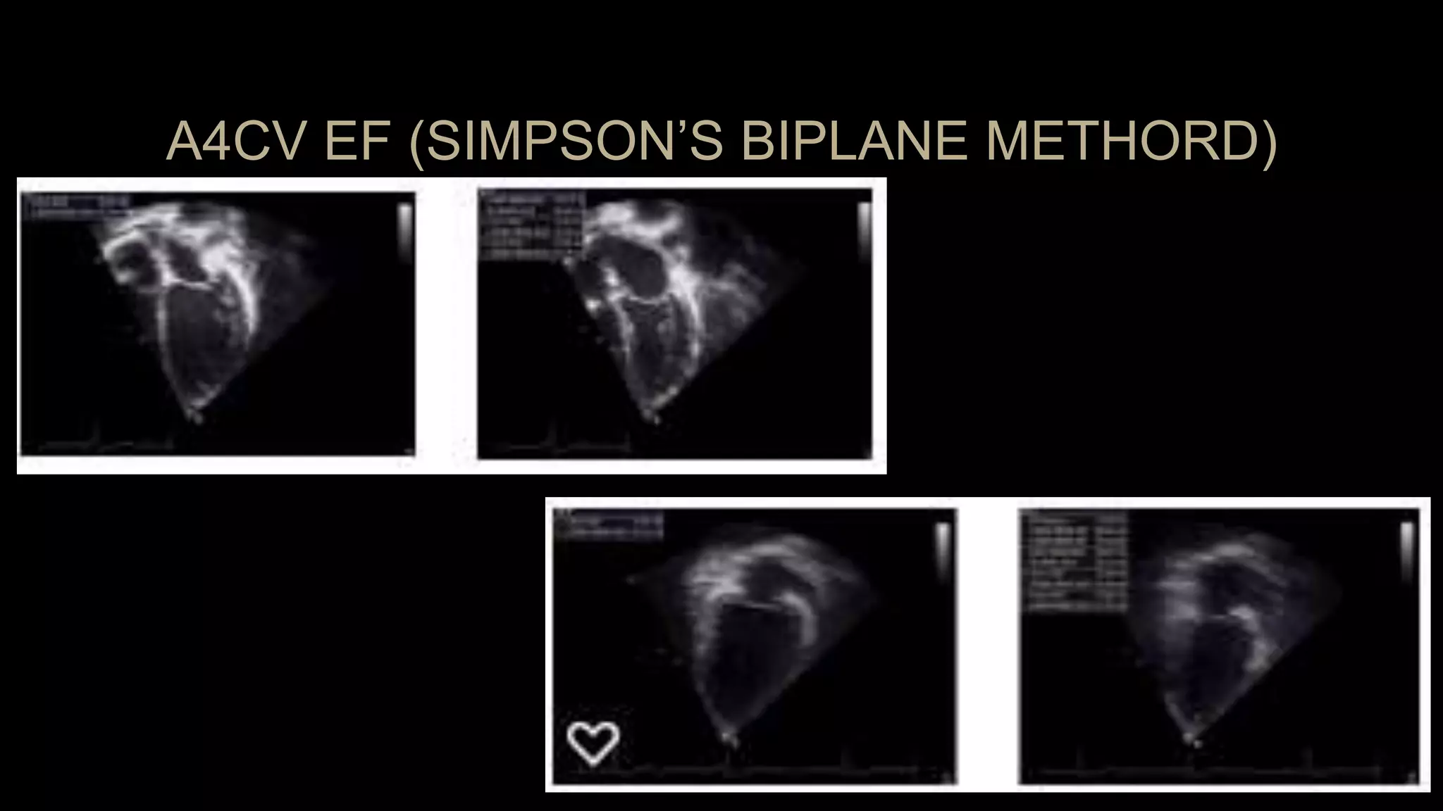 PEDIATRIC ECHOCARDIOGRAPHY: APICAL AND PARASTERNAL VIEWS | PPTX