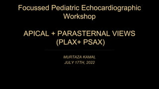 Focussed Pediatric Echocardiographic
Workshop
APICAL + PARASTERNAL VIEWS
(PLAX+ PSAX)
MURTAZA KAMAL
JULY 17TH, 2022
 