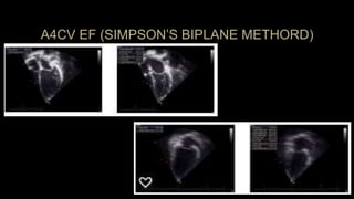 PEDIATRIC ECHOCARDIOGRAPHY: APICAL AND PARASTERNAL VIEWS | PPTX