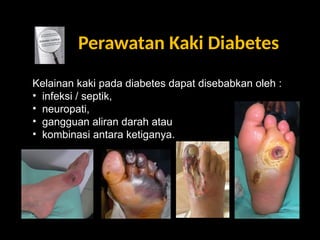 bahaya diabetes melitus dn komplikasi nyapptx | PPT