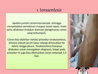 1. torasentesis
Apabila jumlah cairannnya banyak, sehingga
menyebabkan penekanan maupun sesak napas, maka
perlu dilakukan tindakan drainase (pengeluaran cairan
yang terkumpul).
Cairan bisa dialirkan melalui prosedur torakosentesis,
dimana sebuah jarum (atau selang) dimasukkan ke
dalam rongga pleura. Torakosentesis biasanya
dilakukan untuk menegakkan diagnosis, tetapi pada
prosedur ini juga bisa dikeluarkan cairan sebanyak 1,5
liter.
 