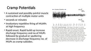 PPT ELECTROMYOGRAPHY BASICS INTERPRETATION AND WAVEFORM ANALYSIS.pptx