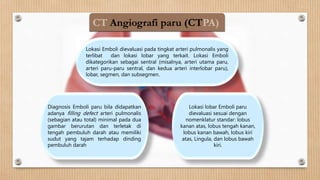 CT Angiografi paru (CTPA)
Diagnosis Emboli paru bila didapatkan
adanya filling defect arteri pulmonalis
(sebagian atau total) minimal pada dua
gambar berurutan dan terletak di
tengah pembuluh darah atau memiliki
sudut yang tajam terhadap dinding
pembuluh darah
Lokasi Emboli dievaluasi pada tingkat arteri pulmonalis yang
terlibat dan lokasi lobar yang terkait. Lokasi Emboli
dikategorikan sebagai sentral (misalnya, arteri utama paru,
arteri paru-paru sentral, dan kedua arteri interlobar paru),
lobar, segmen, dan subsegmen.
Lokasi lobar Emboli paru
dievaluasi sesuai dengan
nomenklatur standar: lobus
kanan atas, lobus tengah kanan,
lobus kanan bawah, lobus kiri
atas, Lingula, dan lobus bawah
kiri.
 