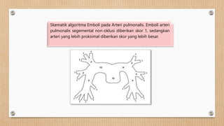 Skematik algoritma Emboli pada Arteri pulmonalis. Emboli arteri
pulmonalis segemental non-oklusi diberikan skor 1, sedangkan
arteri yang lebih proksimal diberikan skor yang lebih besar.
 