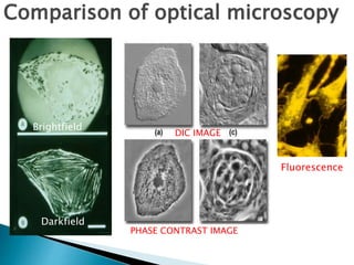 Darkfield
Brightfield
Darkfield
Fluorescence
Comparison of optical microscopy
DIC IMAGE
PHASE CONTRAST IMAGE
 