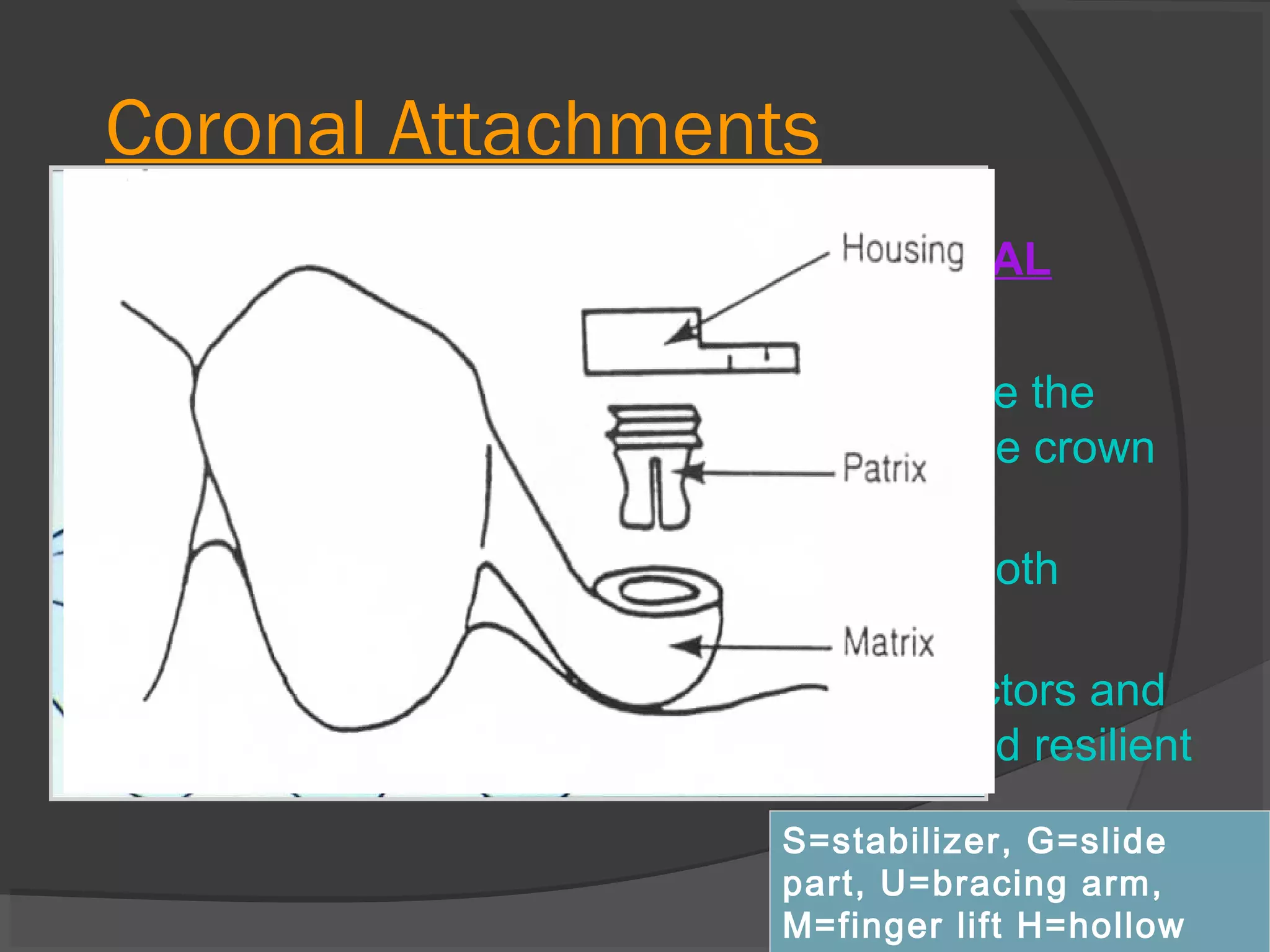Coronal Attachments
INTRACORONAL:

EXTRACORONAL

Placed within the
contours of the crown
form
 Needs more tooth
reduction
 Rigid connectors





Placed outside the
contours of the crown
form
 Needs less tooth
reduction
 Stress redirectors and
are considered resilient
S=stabilizer, G=slide
part, U=bracing arm,
M=finger lift H=hollow

 