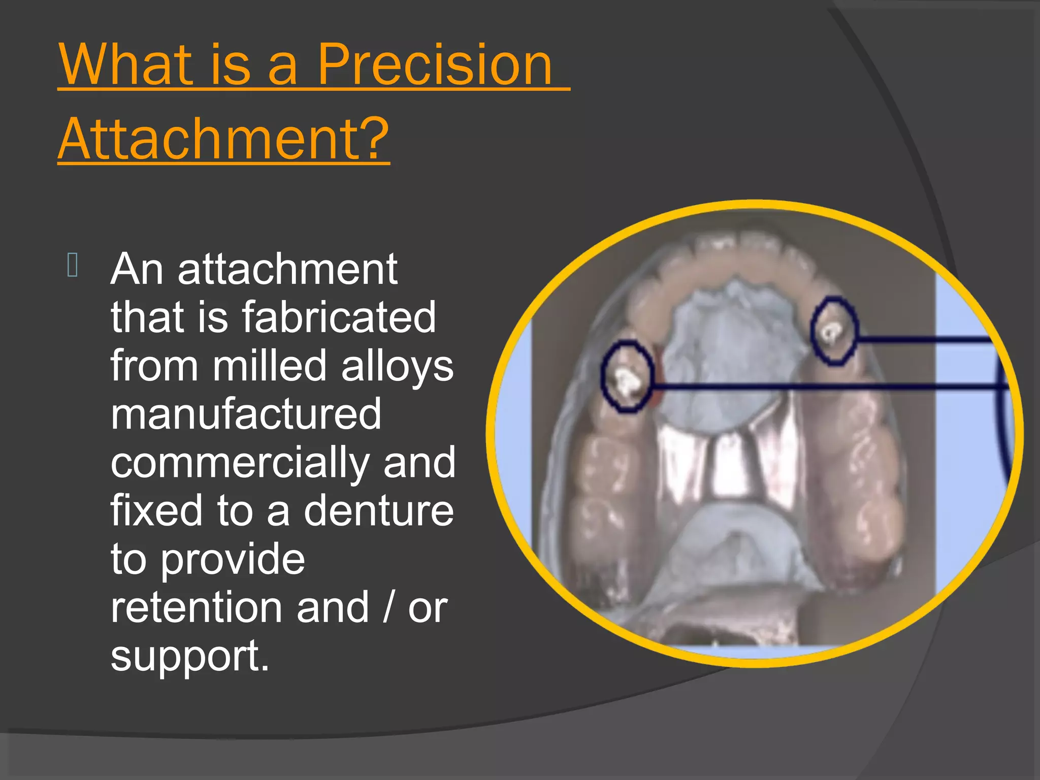 What is a Precision
Attachment?


An attachment
that is fabricated
from milled alloys
manufactured
commercially and
fixed to a denture
to provide
retention and / or
support.

 