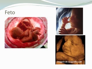 FetoImagem de ecografia a 3D