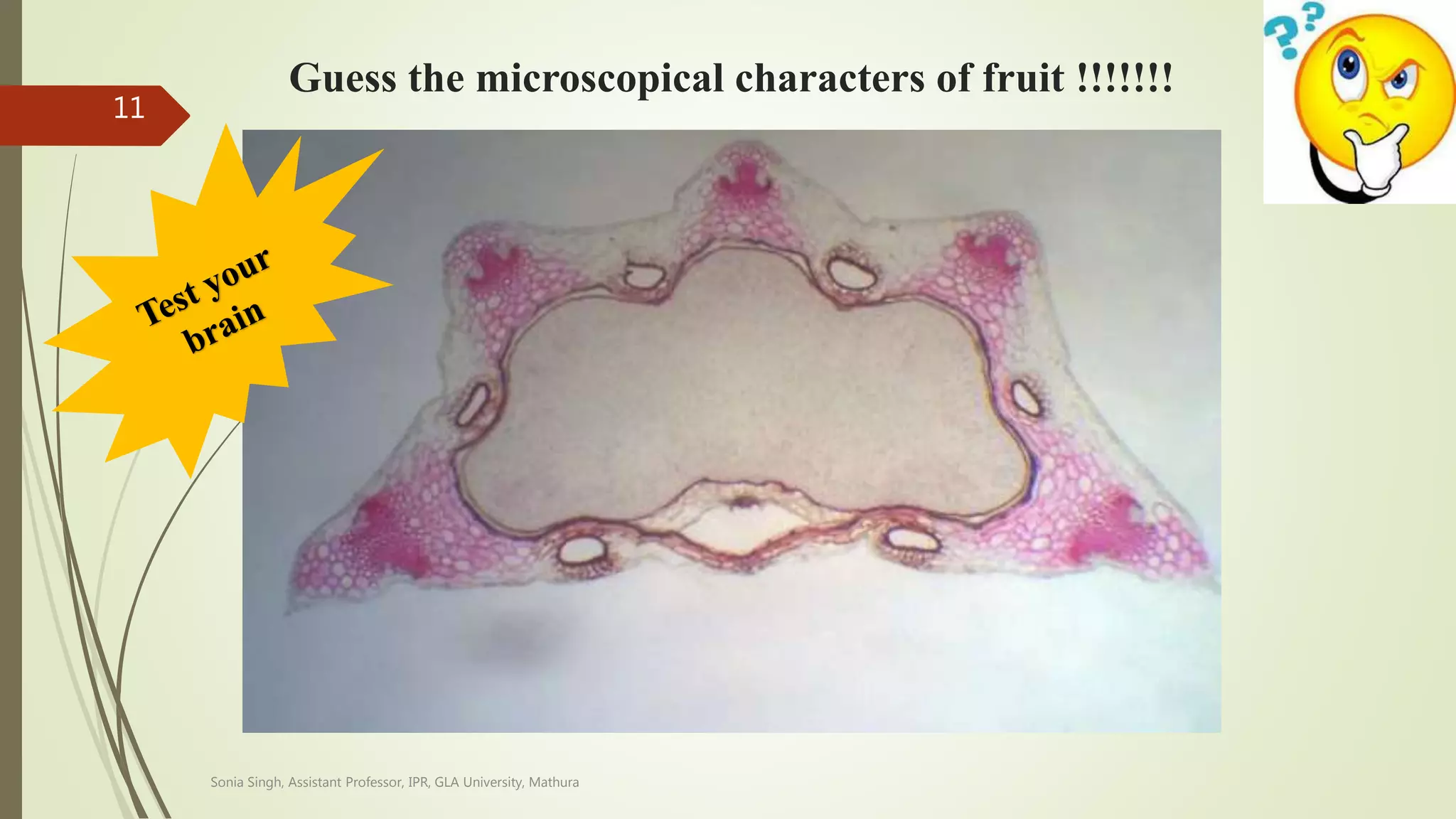 Guess the microscopical characters of fruit !!!!!!!
Sonia Singh, Assistant Professor, IPR, GLA University, Mathura
11
 