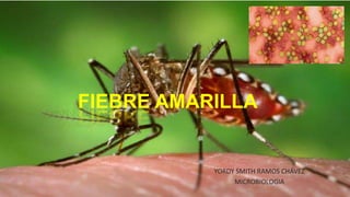 FIEBRE AMARILLA
YORDY SMITH RAMOS CHÁVEZ
MICROBIOLOGIA
 