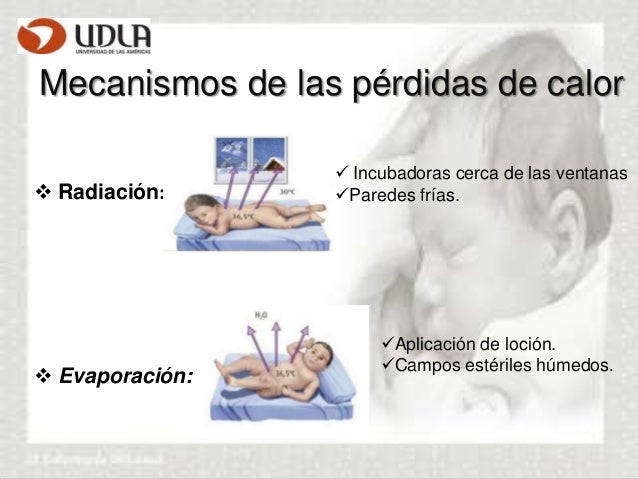 Hipoglicemia y Termorregulación en el RN