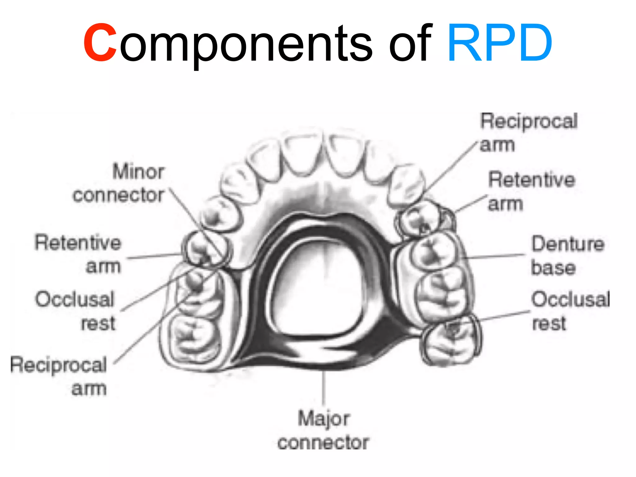 PPT (FINAL)The principles of RPD design & its components (Year 3) .pptx