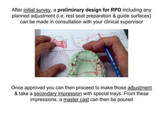 Resin Rest Rpd PPT (FINAL)The principles of RPD design & its components (Year 3) .pptx