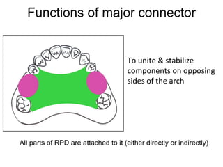 Rpd Rope Link PPT (FINAL)The principles of RPD design & its components (Year 3) .pptx