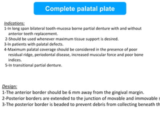 Open Palatal Rpd PPT (FINAL)The principles of RPD design & its components (Year 3) .pptx