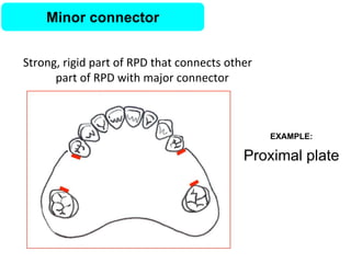 Rest Connector Rpd PPT (FINAL)The principles of RPD design & its components (Year 3) .pptx