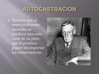    Persona que al
    tener problemas
    mentales se
    produce una auto
    corte de su pene
    que le produce
    placer sin importar
    las consecuencias.
 